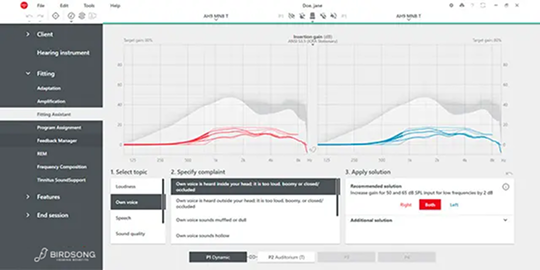 fitting software audiograph